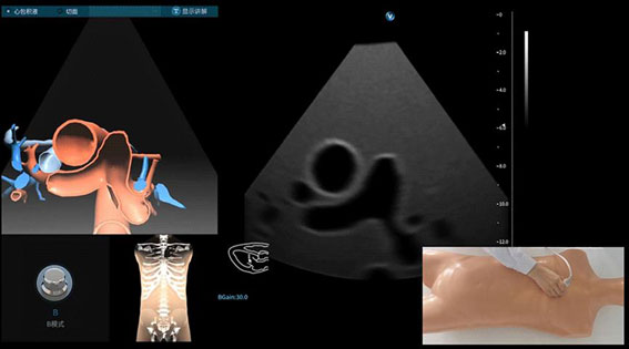 超声模拟实训系统 单机版（女）